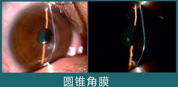 眼睛疼?视力剧降?小心隐藏着可怕的真相!