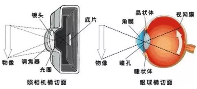眼睛疼?视力剧降?小心隐藏着可怕的真相!