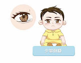倒睫1.png