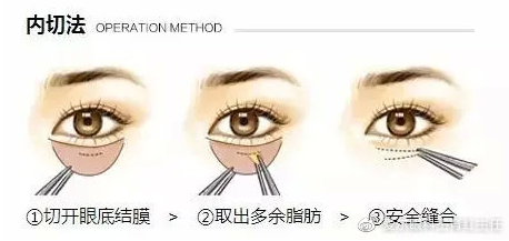 33.png